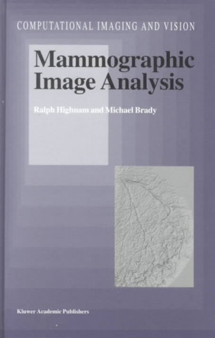Carte Mammographic Image Analysis Ralph Highnam