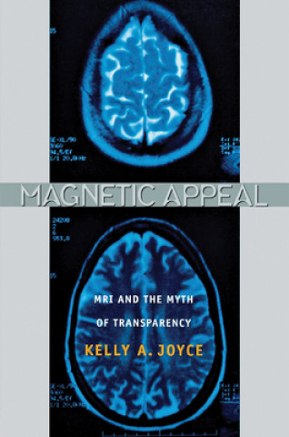 Livre Magnetic Appeal: MRI and the Myth of Transparency Kelly A. Joyce