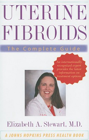 Kniha Uterine Fibroids: The Complete Guide Elizabeth A. Stewart