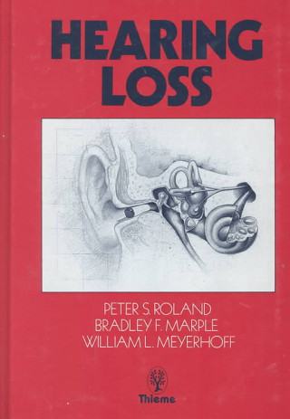 Könyv Hearing Loss Peter S. Roland