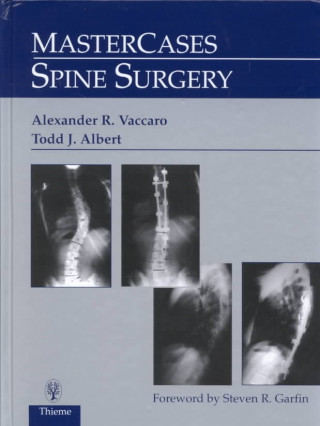 Knjiga MasterCases in Spine Surgery Alexander R. Vaccaro