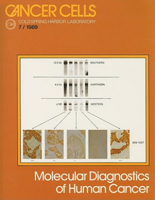 Książka Molecular Diagnostics of Human Cancer Mark Furth