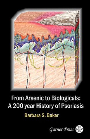 Kniha From Arsenic to Biologicals: A 200 Year History of Psoriasis Barbara S. Baker