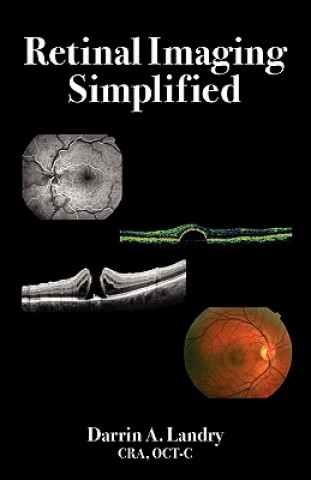 Książka Retinal Imaging Simplified Darrin A. Landry