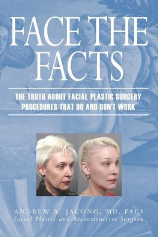 Книга Face the Facts: The Truth about Facial Plastic Surgery Procedures That Do and Don't Work Andrew A. Jacono