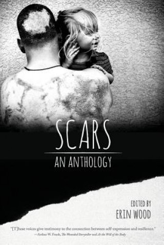 Carte Scars: An Anthology Erin Wood