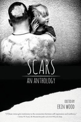 Könyv Scars: An Anthology Erin Wood