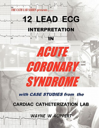 Könyv 12 Lead ECG Interpretation in Acute Coronary Syndrome with Case Studies from the Cardiac Catheterization Lab Wayne W Ruppert