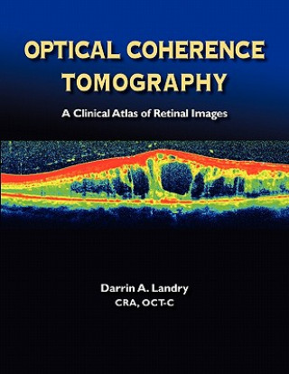 Книга Optical Coherence Tomography a Clinical Atlas of Retinal Images Darrin A. Landry