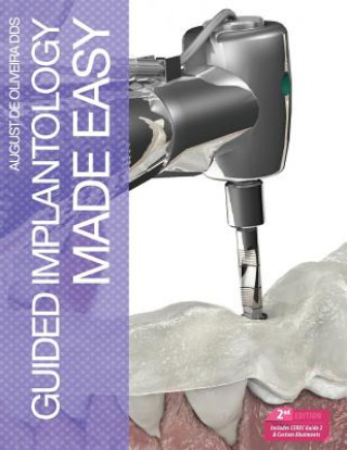 Kniha Guided Implantology Made Easy August De Oliveira