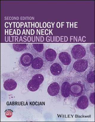 Könyv Cytopathology of the Head and Neck - Ultrasound Guided FNAC 2e Gabrijela Kocjan