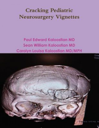Książka Cracking Pediatric Neurosurgery Vignettes Paul Edward Kaloostian MD