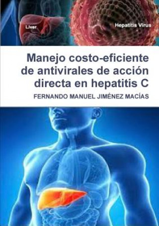 Könyv Manejo Costo-Eficiente De Antivirales De Accion Directa En Hepatitis C Fernando Manuel Jimenez Macias