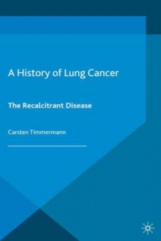 Kniha History of Lung Cancer Carsten Timmermann