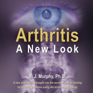 Könyv Arthritis-A New Look R. J. Murphy