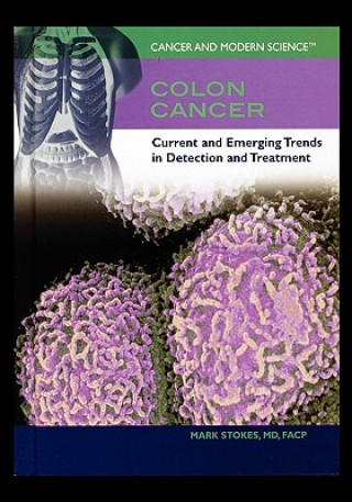 Carte Colon Cancer: Current and Emerging Trends in Detection and Treatment Mark Stokes