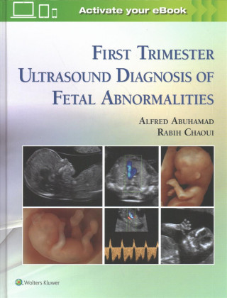 Książka First Trimester Ultrasound Diagnosis of Fetal Abnormalities Alfred Abuhamad