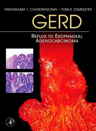 Kniha Gerd: Reflux to Esophageal Adenocarcinoma Parakrama T. Chandrasoma