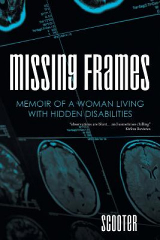 Book Missing Frames Scooter