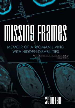 Book Missing Frames Scooter