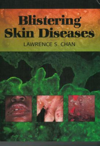 Carte Blistering Skin Diseases Lawrence S. Chan