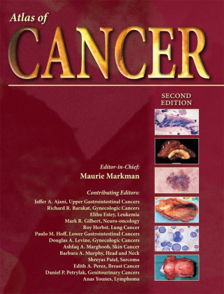 Livre Atlas of Cancer Maurie Markman