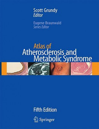 Könyv Atlas of Atherosclerosis and Metabolic Syndrome Scott M. Grundy