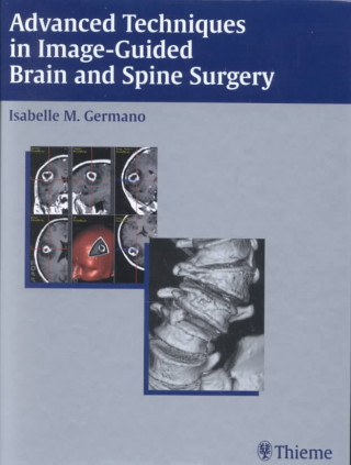 Kniha Advanced Techniques in Image-Guided Brain and Spine Surgery Isabelle M. Germano