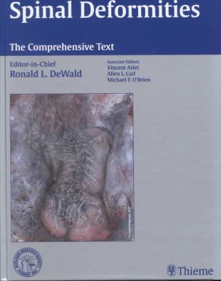 Kniha Spinal Deformities: The Comprehensive Text Vincent Arlet