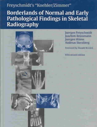 Kniha Koehler/Zimmer Borderlands of Normal and Early Pathological Findings in Skeletal Radiography Jurgen Freyschmidt