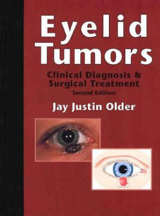 Book Eyelid Tumors: Clinical Diagnosis and Surgical Treatment Jay Justin Older