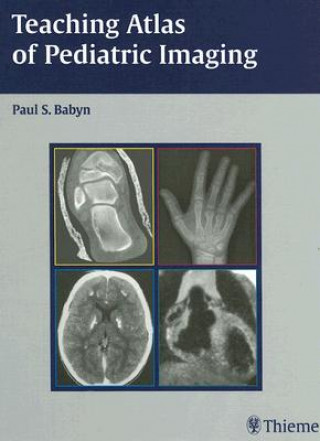 Carte Teaching Atlas of Pediatric Imaging Paul S. Babyn