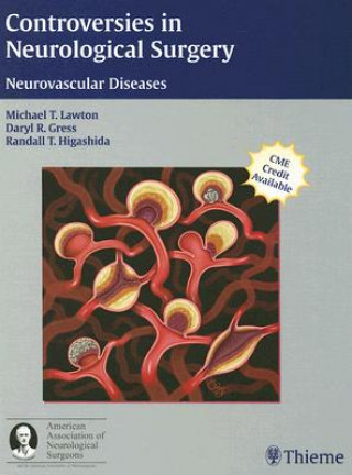 Książka Controversies in Neurological Surgery Michael T. Lawton