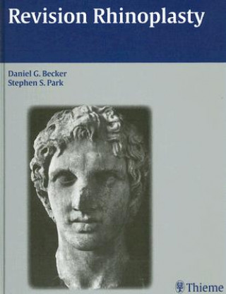 Kniha Revision Rhinoplasty Daniel G. Becker