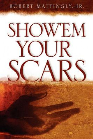 Kniha Show'em Your Scars Robert Mattingly