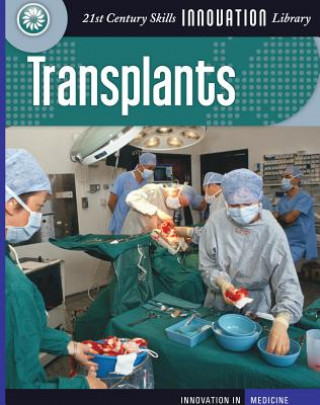 Buch Transplants Susan H. Gray