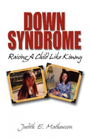 Carte Down Syndrome, Raising A Child Like Kimmy Judith Mathewson