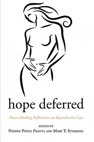 Könyv Hope Deferred Serene Jones