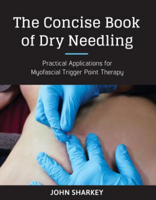 Carte Concise Book of Dry Needling John Sharkey