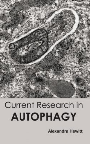 Книга Current Research in Autophagy Alexandra Hewitt