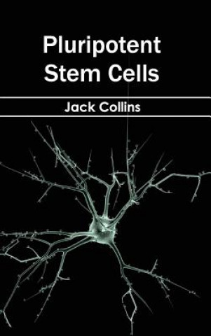 Carte Pluripotent Stem Cells Jack Collins