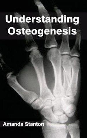 Book Understanding Osteogenesis Amanda Stanton
