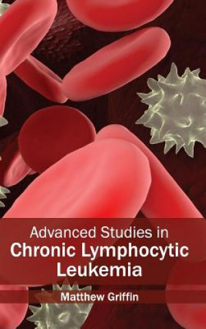 Book Advanced Studies in Chronic Lymphocytic Leukemia Matthew Griffin