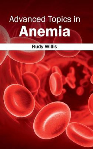 Knjiga Advanced Topics in Anemia Rudy Willis