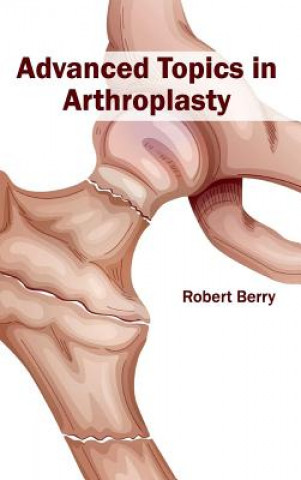 Kniha Advanced Topics in Arthroplasty Robert Berry