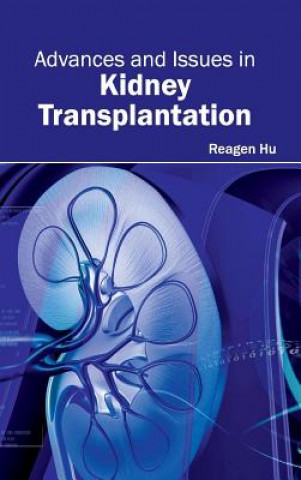 Книга Advances and Issues in Kidney Transplantation Reagen Hu