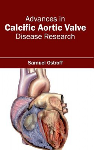 Kniha Advances in Calcific Aortic Valve Disease Research Samuel Ostroff