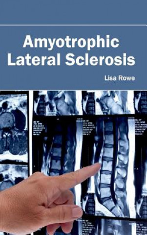 Könyv Amyotrophic Lateral Sclerosis Lisa Rowe