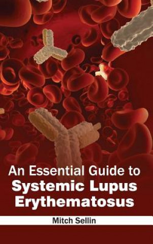Knjiga Essential Guide to Systemic Lupus Erythematosus Mitch Sellin