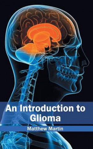 Kniha Introduction to Glioma Matthew Martin
